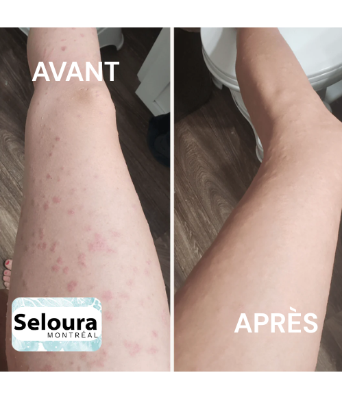 Gant exfoliant en profondeur