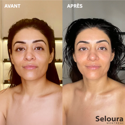 Brosse lymphatique pour le visage
