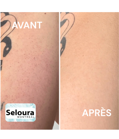 Gant exfoliant en profondeur