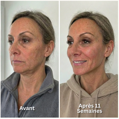 Collagen Face Sculpt Wrap