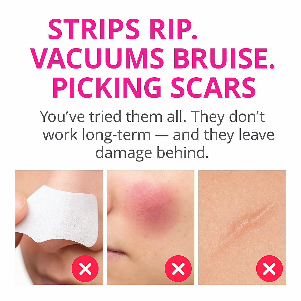 Seloura Montréal Blackhead Remover Pore Vaccum