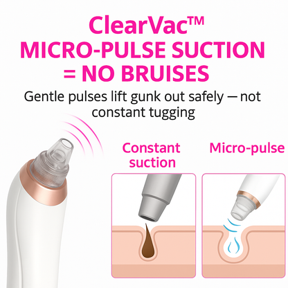 Seloura Montréal Blackhead Remover Pore Vaccum