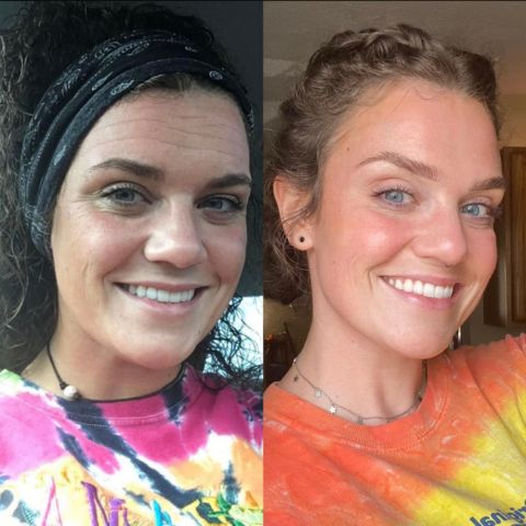 Feuilles de silicone pour cicatrices