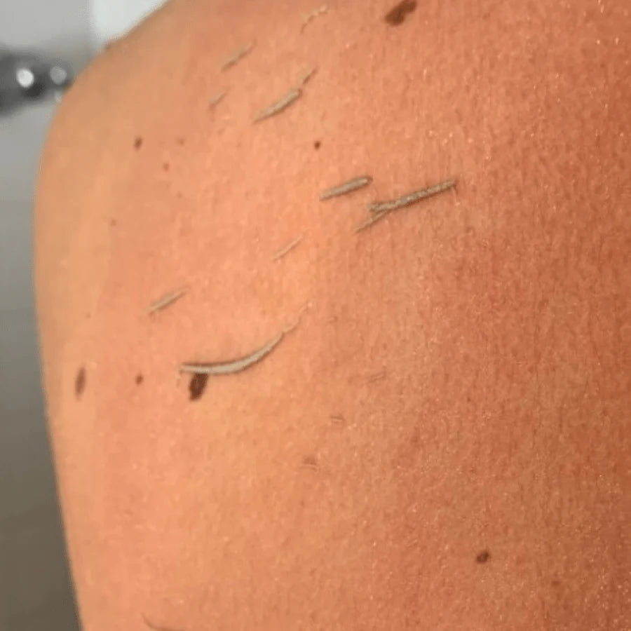 Gant exfoliant en profondeur