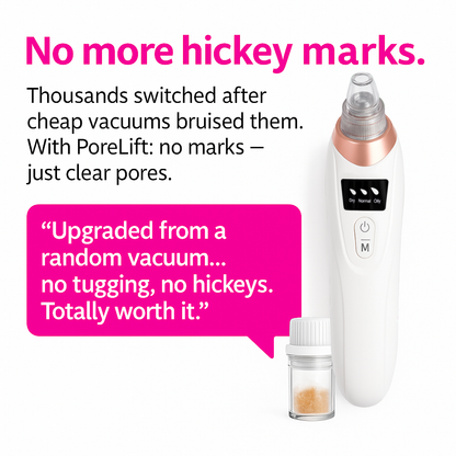 Seloura Montréal Blackhead Remover Pore Vaccum