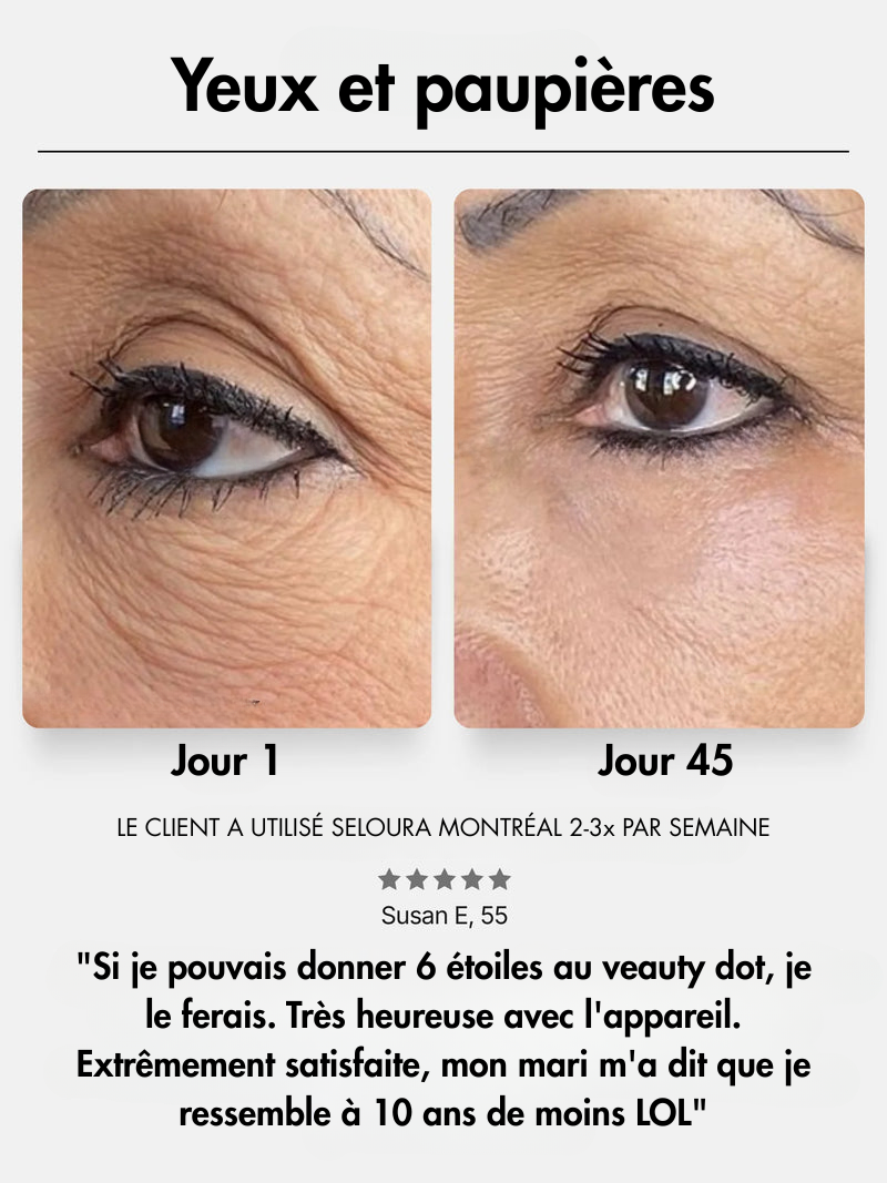 Dot & Aqualis Activator