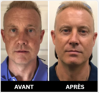 Le secret pour la mâchoire dont vous avez toujours rêvé