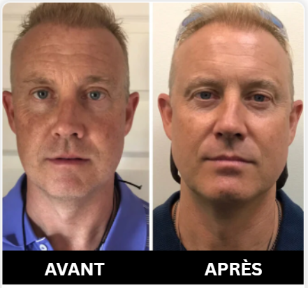 Le secret pour la mâchoire dont vous avez toujours rêvé