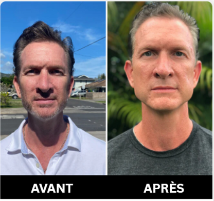 Le secret pour la mâchoire dont vous avez toujours rêvé